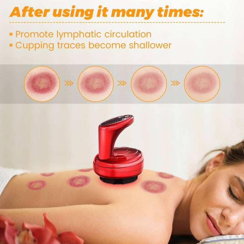 Electric Cupping Therapy Machine